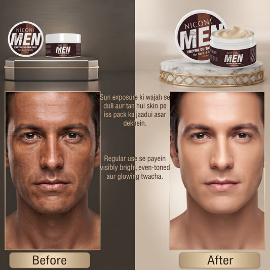 Niconi Men Enzyme De-Tan Pack (300g) – Professional Face & Body Tan Removal Treatment for Men