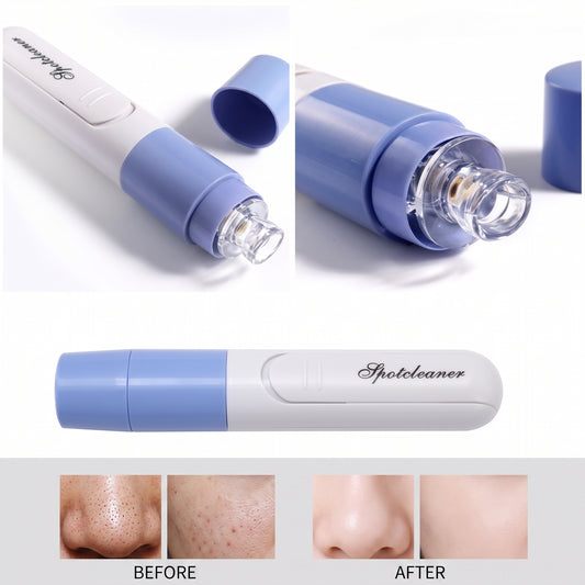 Electric Black Head Remover